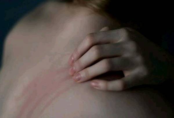 Scars    It can never effect your soul nor your heart