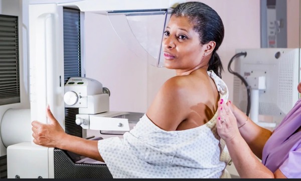 Mininum mammogram age should be lowered to 30