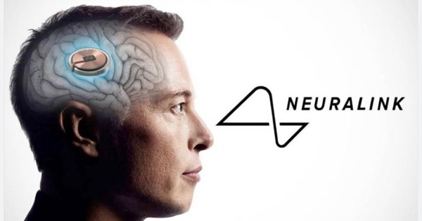 Musk Neuralink Progress
