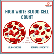 High white blocs cell count