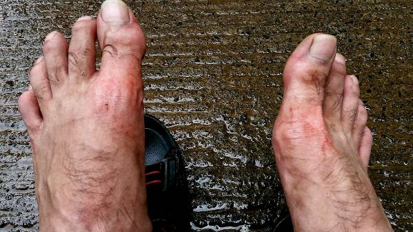 Bloodied feet at Sinhagad - why experimenting is not always good
