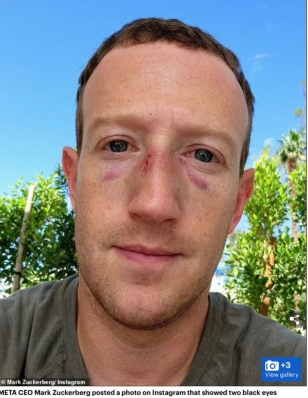 Zuckerberg blackeyes
