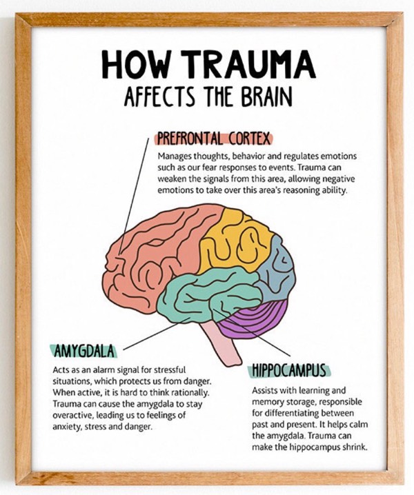 Trauma Build Up - Part 2 Defining & the Brain