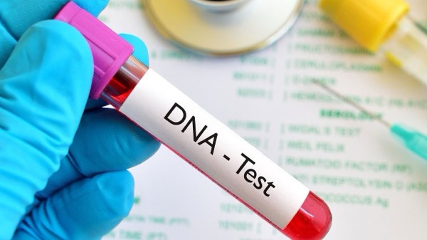 Mandatory DNA test